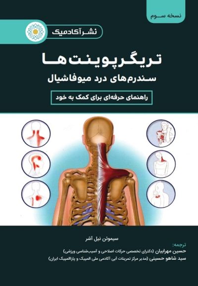 تریگرپوینت ها